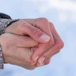 طبيبة تحذر الأردنيين من "لسعة الصقيع": اتبعوا هذه الإجراءات