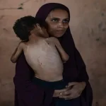 الأمم المتحدة تعلن رسميا تفشي المجاعة بغزة 