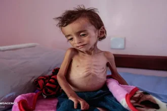 التجويع يودي بحياة 5 مواطنين بينهم طفلان خلال يوم