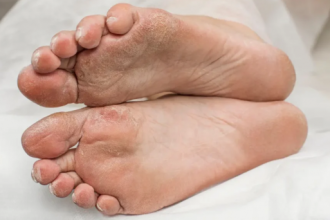 جزء من قدم بشرية