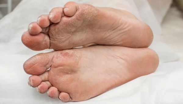 جزء من قدم بشرية